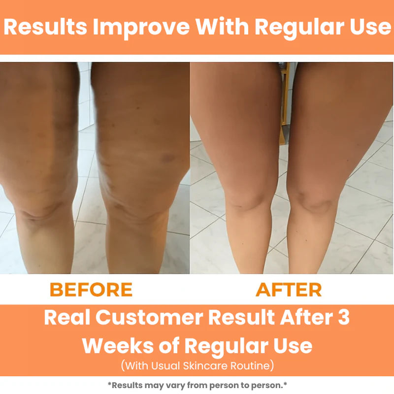 Botiva™ Deep Tissue Massage Roller