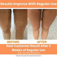 Botiva™ Deep Tissue Massage Roller